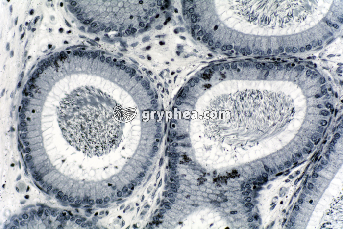 Epididyme x100 - gryphea.com